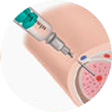 injection Injection