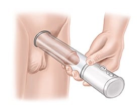 vacuum erection device
