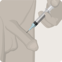 new-penile-injections-ed-background