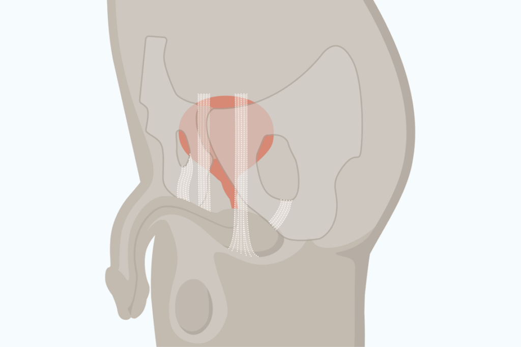 cpmh-male-sling_SUI-final