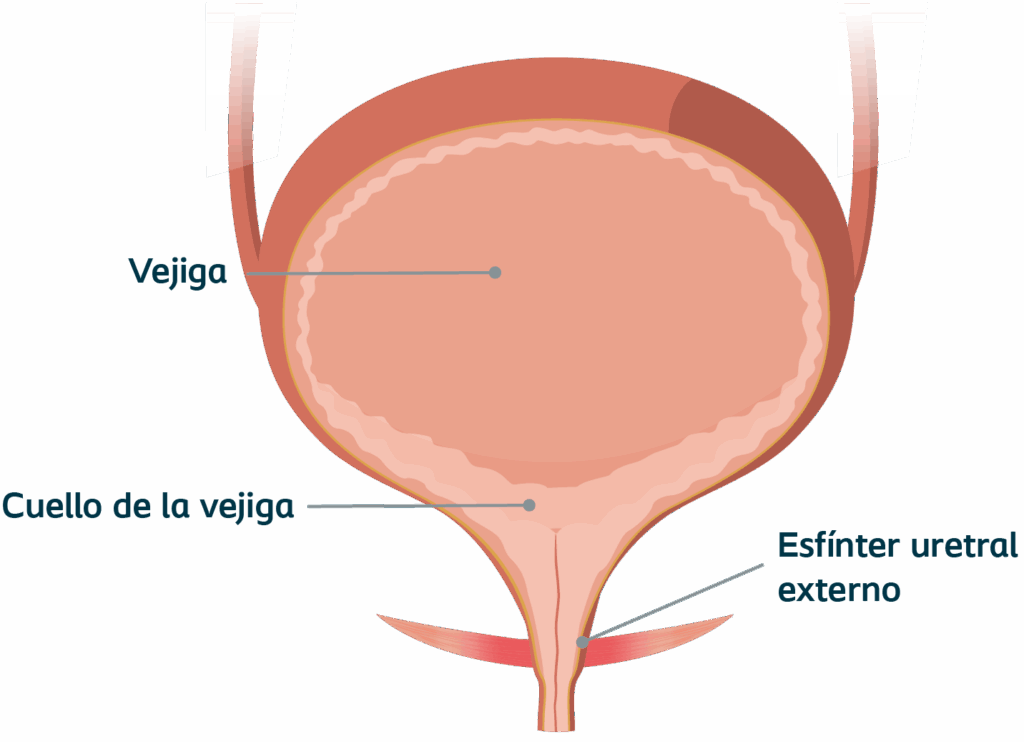 cpmh_sui_post-prostatectomy